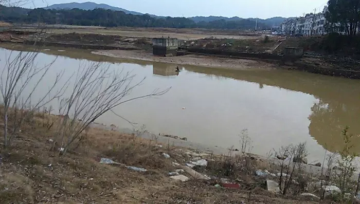 海南旅游预见美 -- 激光去黑眼圈，拥有好眼色‘mk体育’